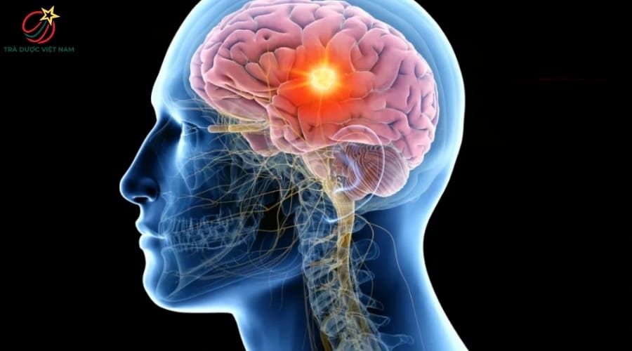 Trà xanh có thể giúp cải thiện sức khỏe não bộ