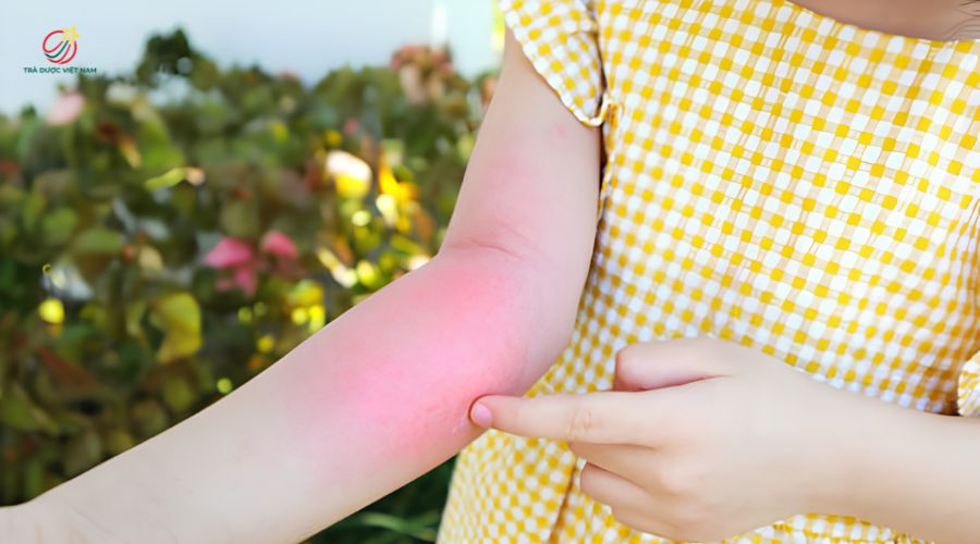 Nếu bạn dị ứng với phấn hoa bạn không nên uống trà hoa hồng